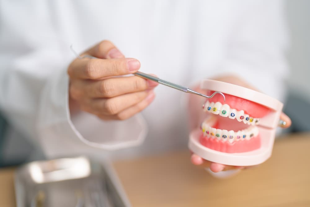 Surcomplémentaire orthodontie adulte : soins et remboursements